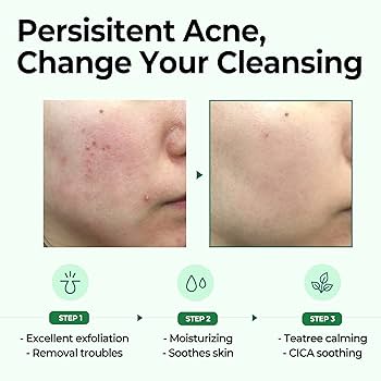 AHA.BHA.PHA 30 Days Miracle Cleansing Bar 106 g -Jabón exfoliante