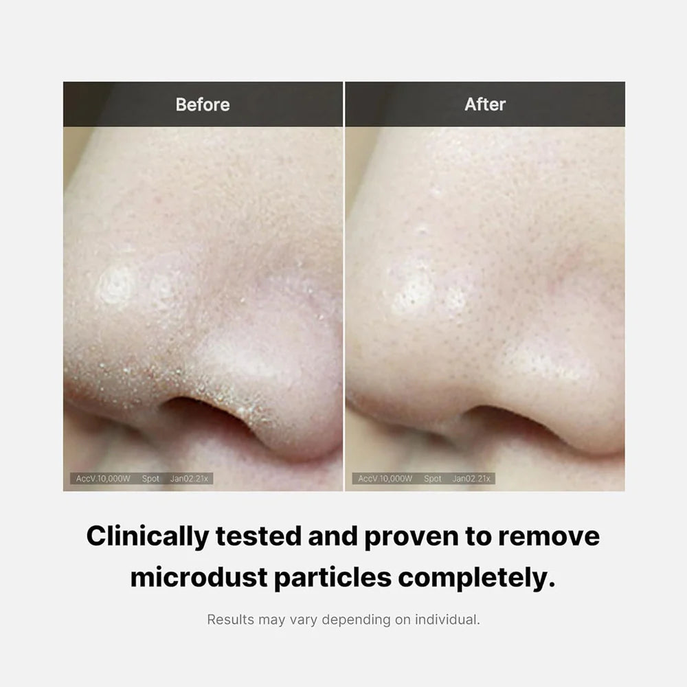 Zero Foam Cleanser (120g) – acné facial y corporal