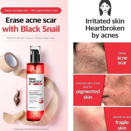 Snail Truecica Miracle Repair Toner 150ml – Calmante y cicatrizante