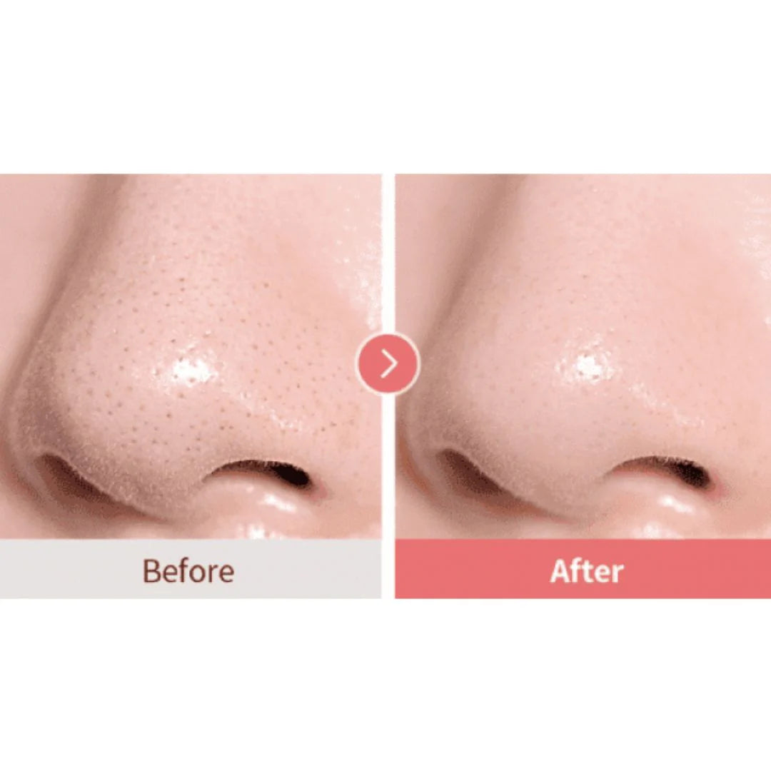 Calamine pore Control Cleansing Oil 2ml (minimuestra)