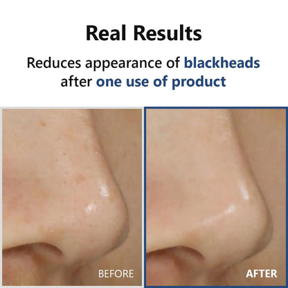 Hyper Acid4 AHA BHA PHA LHA 30 Serum 20ml - mejora la textura