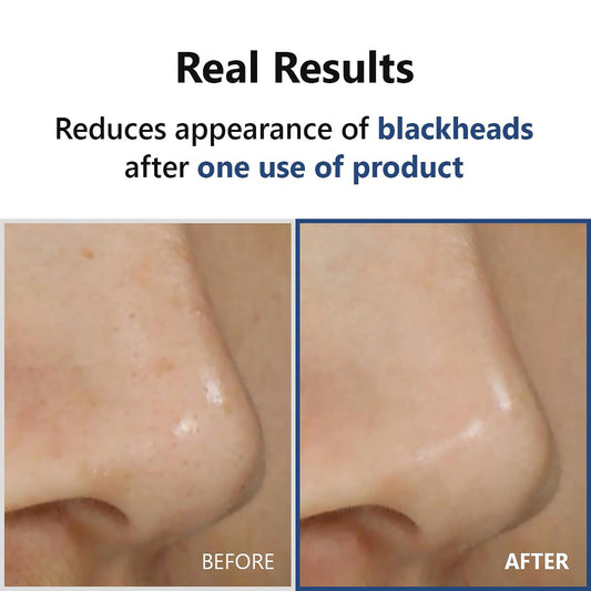 Hyper Acid4 AHA BHA PHA LHA 30 Serum 20ml - mejora la textura