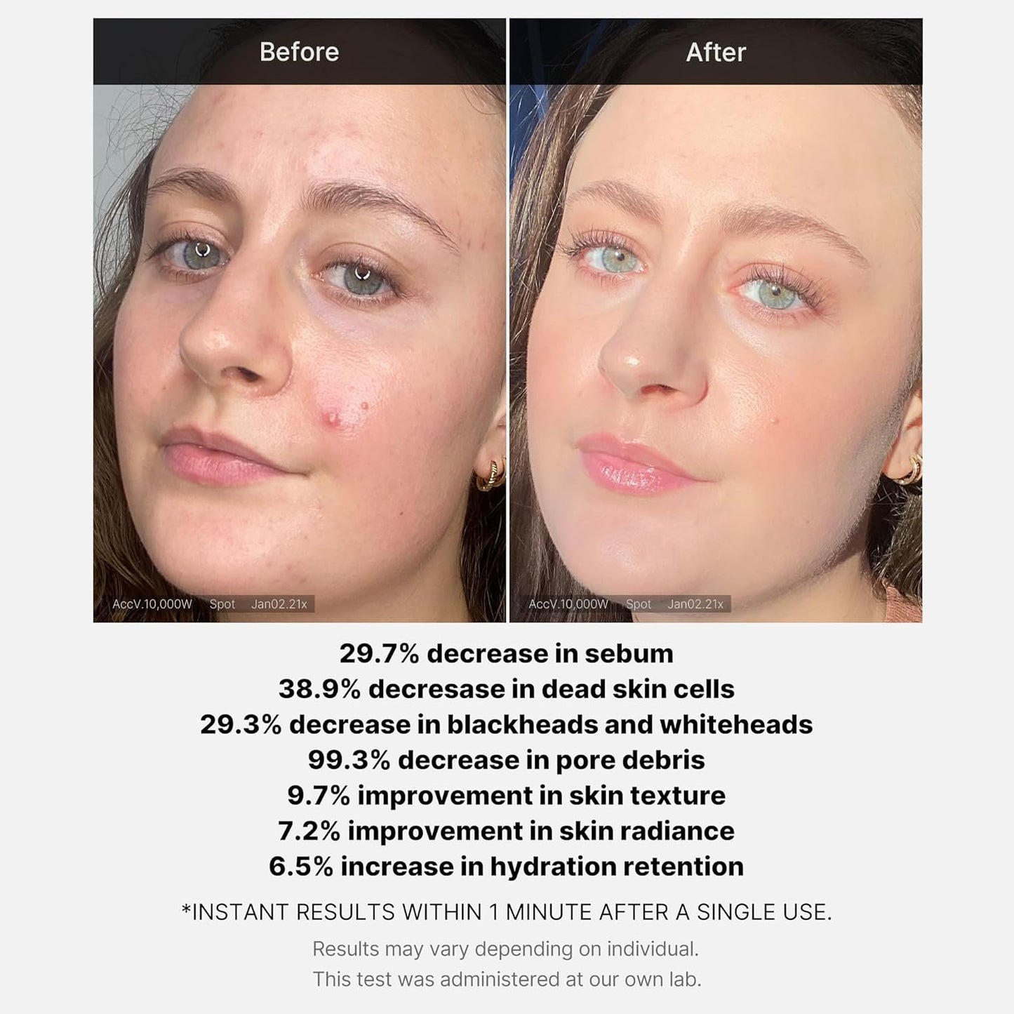 RED Succinic Acid Clarifying Serum - purifica y fortalece la piel (30 ml)