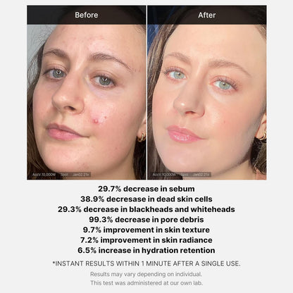 RED Succinic Acid Clarifying Serum - purifica y fortalece la piel (30 ml)