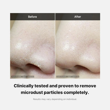 Zero Foam Cleanser (120g)  – acné facial y corporal 