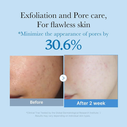 Zero Pore Toner (250ml): exfolia e hidrata sin irritar