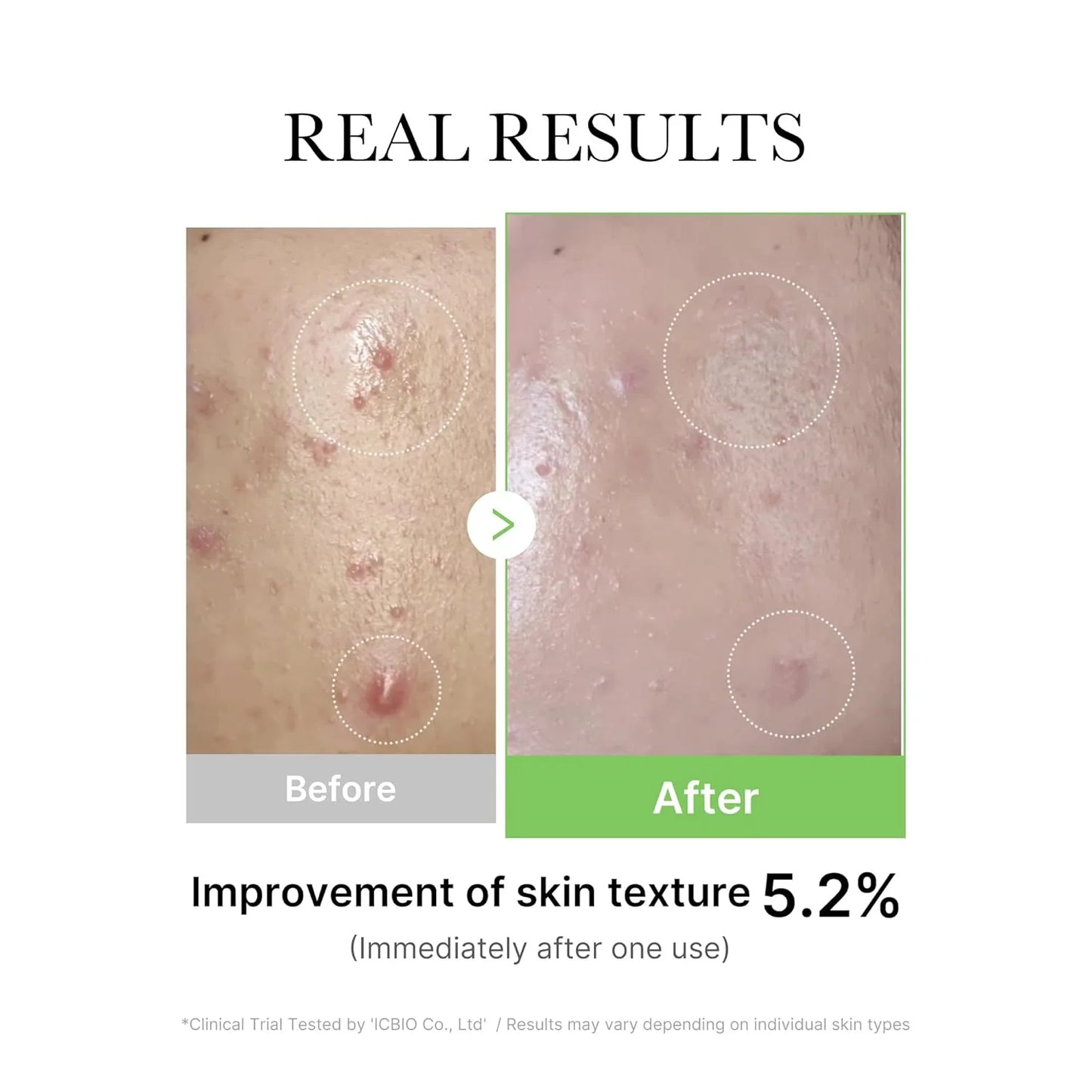 Exosome Cica Ampoule (30ml) -Calma irritaciones