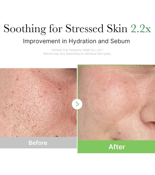  Exosome Cica Cream (50ml) - Calma irritaciones