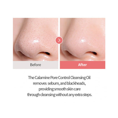 Calamine pore Control Cleansing Oil 20ml - absorbe el sebo