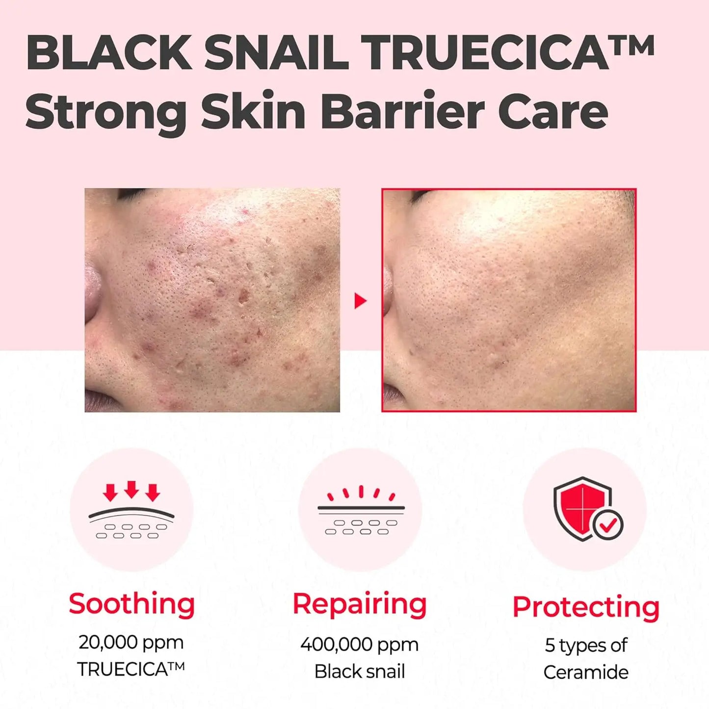 Snail Truecica Miracle Repair Cream 60g - Recuperadora y calmante